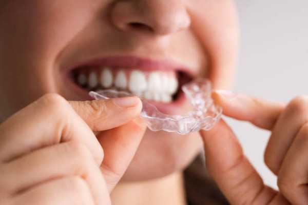 Choosing the Right Local Dentist for Invisible Dental Aligners: A Guide