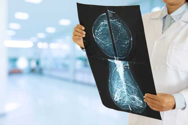 The Evolution of HER2-Positive Breast Cancer Treatment: A New Era of Targeted Therapies